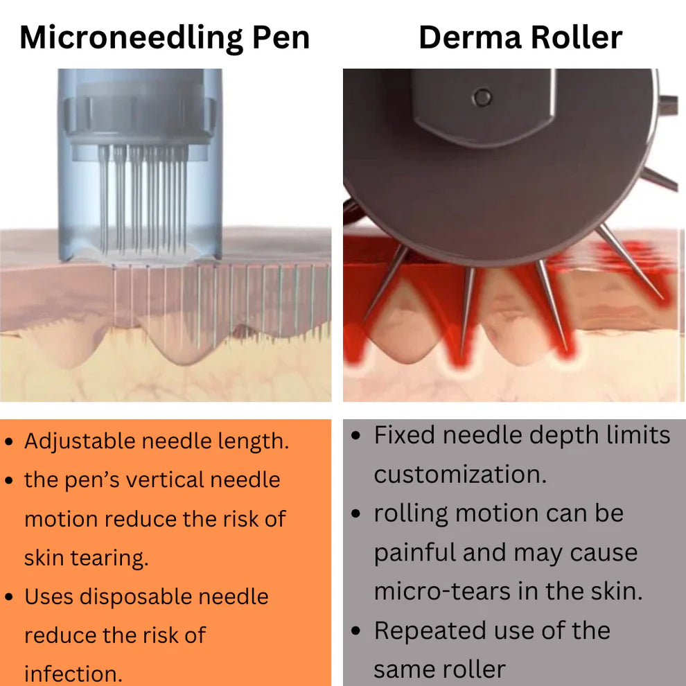 Pro-Level Microneedling System – Includes 12 Precision Cartridges for Glowing Skin