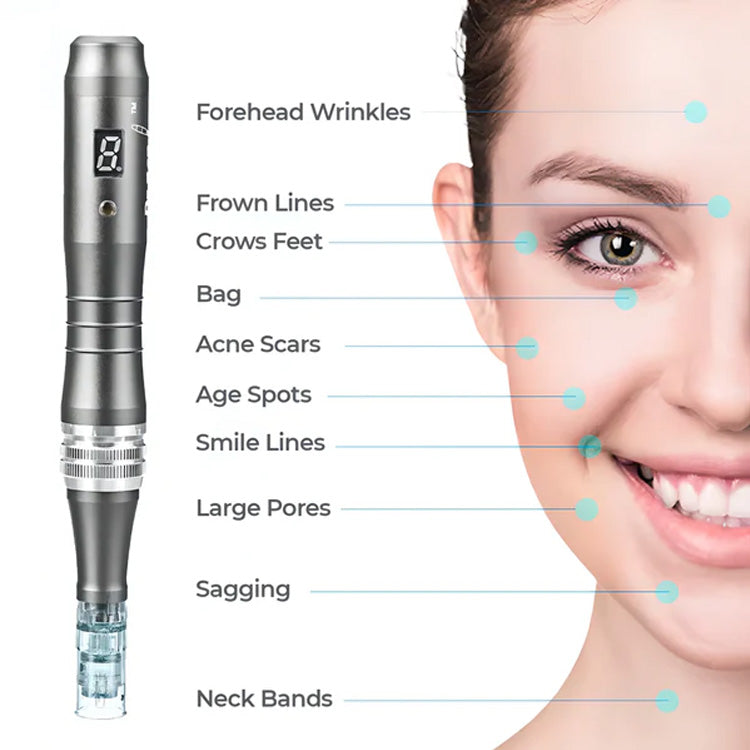 Pro-Level Microneedling System – Includes 12 Precision Cartridges for Glowing Skin