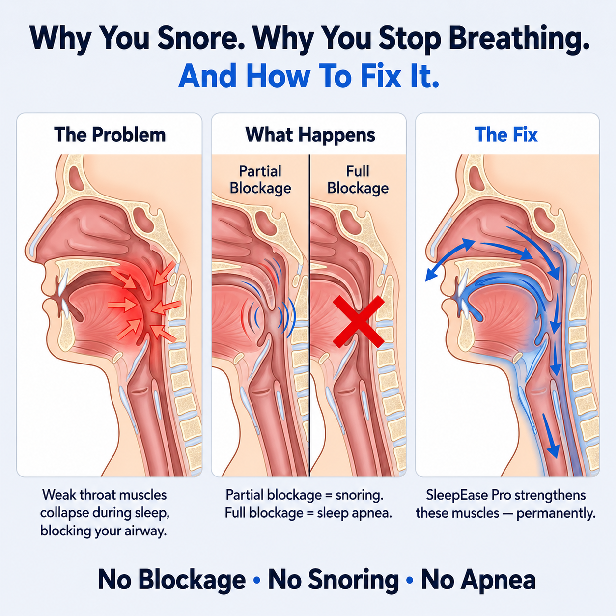 Vitaxe SleepEase Pro — Eliminates Snoring & Sleep Apnea